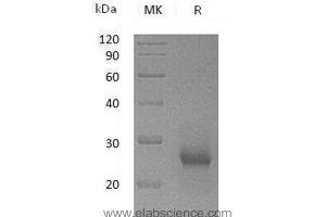 Western Blotting (WB) image for TIMP Metallopeptidase Inhibitor 1 (TIMP1) protein (ABIN7320662) (TIMP1 Protéine)