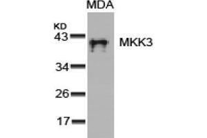 Image no. 3 for anti-Mitogen-Activated Protein Kinase Kinase 3 (MAP2K3) (Ser189) antibody (ABIN197297)