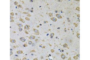 Immunohistochemistry of paraffin-embedded Rat brain using RhoA Polyclonal Antibody at dilution of 1:100 (40x lens). (RHOA anticorps)