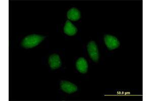 Immunofluorescence of purified MaxPab antibody to PPP1R13L on HeLa cell.
