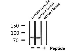 Western blot analysis of extracts from mouse muscle and mouse brain, using USP51 Antibody. (USP51 anticorps)