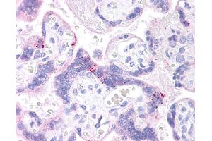 ABCB1 antibody was used for immunohistochemistry at a concentration of 4-8 ug/ml. (ABCB1 anticorps)