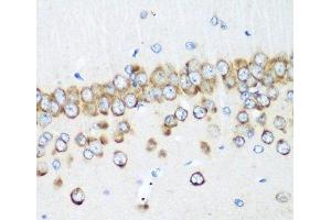 Immunohistochemistry of paraffin-embedded Rat brain using MTDH Polyclonal Antibody at dilution of 1:200 (40x lens). (MTDH anticorps)