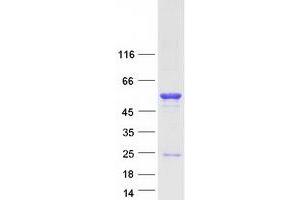 Validation with Western Blot
