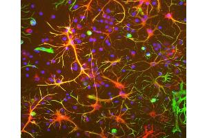 Neuron-glia cell mixed cultures stained with ABIN1842234 (red) and our chicken polyclonal antibody against vimentin: CPCA-Vim (green). (Aldehyde Dehydrogenase H1L1 anticorps)