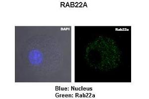 Lanes: Murin JAWS-II cells Primary Antibody Dilution: 1:1000Secondary Antibody: Anti-rabbit-FITC Secondary Antibody Dilution: 1:0500  Gene Name: Blue: Nucleus Green: Rab22a Submitted by: RAB22A