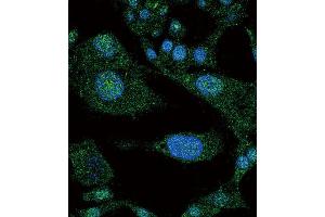 Immunofluorescence (IF) image for anti-Notch 3 (NOTCH3) antibody (ABIN3002554) (NOTCH3 anticorps)