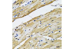 Immunohistochemistry of paraffin-embedded rat heart using GOT1 antibody.