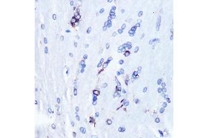 Immunohistochemistry of paraffin-embedded rat brain using YB-1/YBX1 Rabbit mAb (ABIN7271410) at dilution of 1:100 (40x lens).