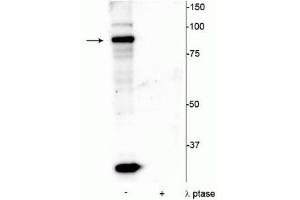 Western blot of mouse testicular lysate showing specific immunolabeling of the ~86 kDa ATRIP protein phosphorylated at Ser239 in the first lane (-). (ATRIP anticorps  (pSer239))