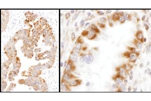 Immunohistochemistry (IHC) image for anti-Isocitrate Dehydrogenase 2 (NADP+), Mitochondrial (IDH2) (AA 402-452) antibody (ABIN7455220)