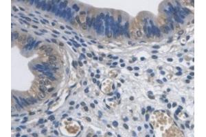 Detection of PCYOX1 in Mouse Uterus Tissue using Polyclonal Antibody to Prenylcysteine Oxidase 1 (PCYOX1)