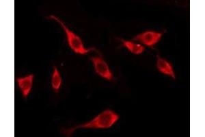 ABIN6276219 staining LOVO by IF/ICC. (TAS2R10 anticorps  (Internal Region))