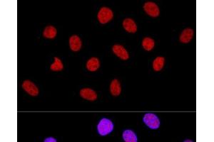 Confocal immunofluorescence analysis of U-2 OS cells using CTCF Polyclonal Antibody at dilution of 1:100.
