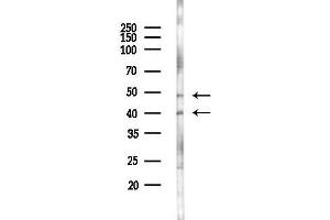Western blot analysis of lysates from K562 cells(UV 30 min treatment), using ADORA Antibody at 1/1000 dilution.