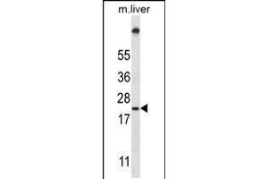 Western blot analysis in mouse liver tissue lysates (35ug/lane). (UBE2W anticorps  (C-Term))