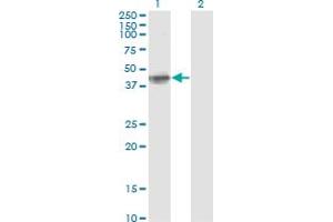 Western Blot analysis of FCER2 expression in transfected 293T cell line by FCER2 monoclonal antibody (M04A), clone S51.