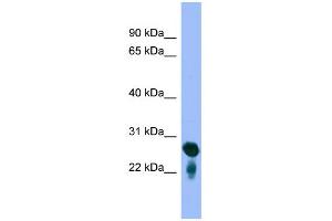 WB Suggested Anti-RAB5C Antibody Titration: 0. (Rab5c anticorps  (Middle Region))