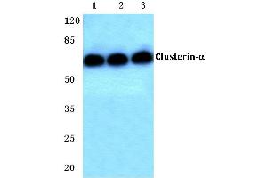 Western blot (WB) analysis of Clusterin-α antibody at 1/500 dilution (Clusterin anticorps)