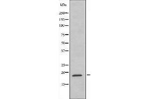 Western blot analysis of extracts from HeLa cells using RPS11 antibody. (RPS11 anticorps  (C-Term))
