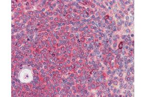 Anti-BACH2 antibody IHC of human spleen.