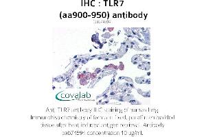 Image no. 2 for anti-Toll-Like Receptor 7 (TLR7) (AA 900-950) antibody (ABIN1740124) (TLR7 anticorps  (AA 900-950))