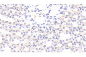 Detection of MIg in Rat Kidney Tissue using Polyclonal Antibody to Monokine Induced By Interferon Gamma (MIg)