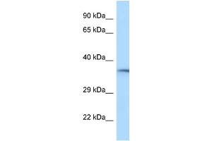 WB Suggested Anti-RGD1310788 Antibody Titration: 1.