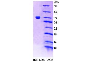 SDS-PAGE analysis of Human TESK1 Protein. (TSSK1 Protéine)