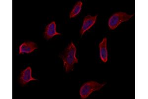 ABIN6262960 and ABIN6273263 staining Hela by IF/ICC. (EIF2D anticorps  (Internal Region))