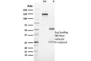 SDS-PAGE Analysis Purified Ki67-Monospecific Mouse Monoclonal Antibody (MKI67/2462). (Ki-67 anticorps  (AA 2293-2478))