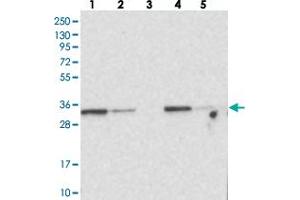Western blot analysis of Lane 1: RT-4, Lane 2: U-251 MG, Lane 3: Human Plasma, Lane 4: Liver, Lane 5: Tonsil with MTCH2 polyclonal antibody . (MTCH2 anticorps)