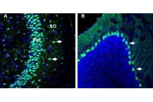 Expression of Kidins220 in mouse hippocampus and cerebellum - Immunohistochemical staining of perfusion-fixed frozen mouse brain sections with Anti-Kidins220 Antibody (ABIN7043293, ABIN7045160 and ABIN7045161), (1:1000), followed by goat-anti-rabbit-AlexaFluor-488. (KIDINS220 anticorps  (Intracellular))