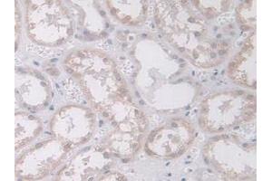 Detection of MAPK12 in Human Kidney Tissue using Polyclonal Antibody to Mitogen Activated Protein Kinase 12 (MAPK12)