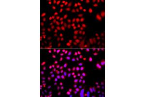 Immunofluorescence analysis of A549 cells using CFL2 antibody. (Cofilin 2 anticorps)