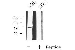 Western blot analysis of MRPL23 using K562 whole cell lysates (MRPL23 anticorps  (Internal Region))