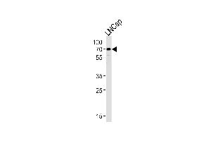 Western blot analysis of lysate from LNCap cell line, using CYP51A1 Antibody at 1:1000 at each lane. (CYP51A1 anticorps  (AA 250-279))