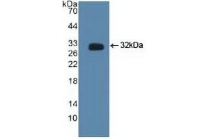 Detection of Recombinant CTBP2, Human using Polyclonal Antibody to C-Terminal Binding Protein 2 (CTBP2)