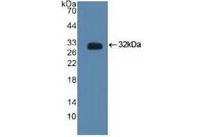Detection of Recombinant CTBP2, Human using Polyclonal Antibody to C-Terminal Binding Protein 2 (CTBP2) (CTBP2 anticorps  (AA 1-252))
