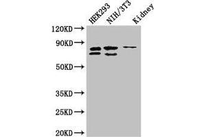 Western Blot Positive WB detected in: HEK293 whole cell lysate, NIH/3T3 whole cell lysate, Mouse kidney tissue All lanes: NUP85 antibody at 2. (NUP85 anticorps  (AA 201-500))