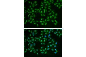 Immunofluorescence (IF) image for anti-Bruton Agammaglobulinemia tyrosine Kinase (BTK) (AA 30-240) antibody (ABIN6218643) (BTK anticorps  (AA 30-240))