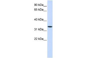 WNT6 antibody used at 1 ug/ml to detect target protein.