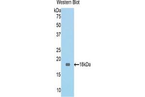 Western blot analysis of the recombinant protein. (MGEA5 anticorps  (AA 83-222))
