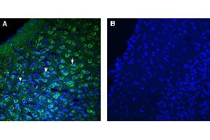 Expression of TMEM175 in mouse piriform cortex. (TMEM175 anticorps  (AA 278-291))