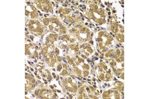 Immunohistochemistry of paraffin-embedded human gastric using HSPE1 antibody (ABIN5975532) at dilution of 1/100 (40x lens). (HSPE1 anticorps)