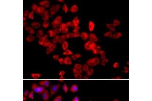 Immunofluorescence analysis of A549 cells using EIF4G1 Polyclonal Antibody