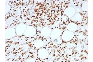 FFPE human angiosarcoma tested with Histone antibody (AE-4) (Histone anticorps)