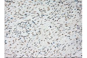 Immunohistochemical staining of paraffin-embedded Ovary tissue using anti-TNNI3mouse monoclonal antibody. (TNNI3 anticorps  (AA 1-210))