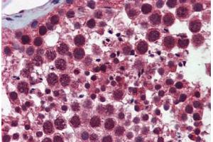 Human Testis: Formalin-Fixed, Paraffin-Embedded (FFPE)