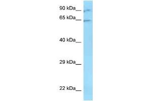 WB Suggested Anti-ZNF280B Antibody   Titration: 1. (ZNF280B anticorps  (N-Term))